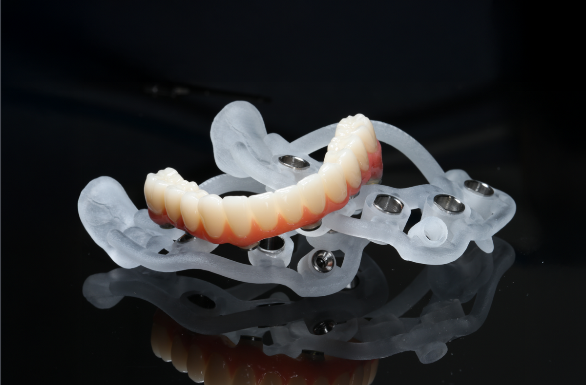 Full Arch Implantology Enters a New Era – MoreDent