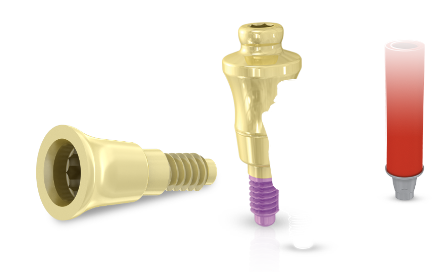 Screw Retention Feature Screw Retained Restoration – MoreDent