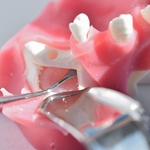 DIA | Advanced Surgical